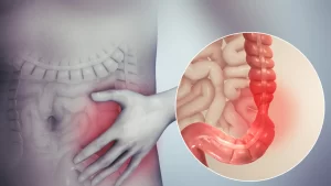 Nutricionista Itaim Bibi - Tatiane Ramos 9 Médico que Cuida do Intestino: Qual Especialista Procurar?